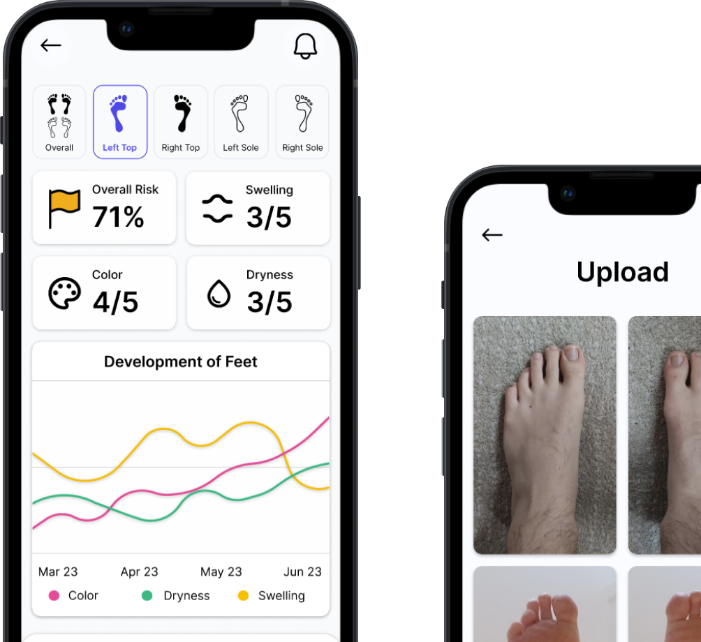 footwatch cover